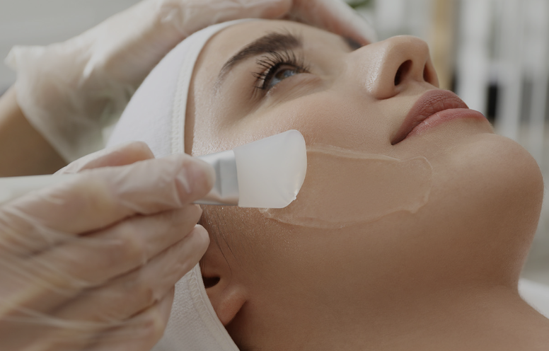 Chemical Peels Treatment