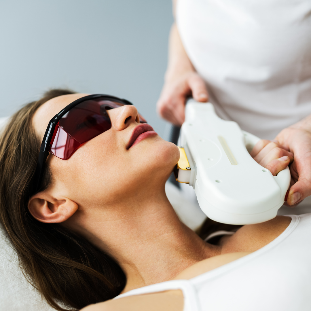 IPL Photofacial Treatment